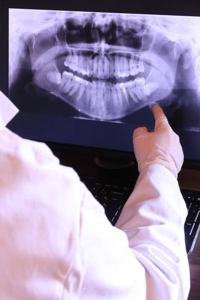 Best Dentist for Tooth Abscess  in Madison Heights, MI