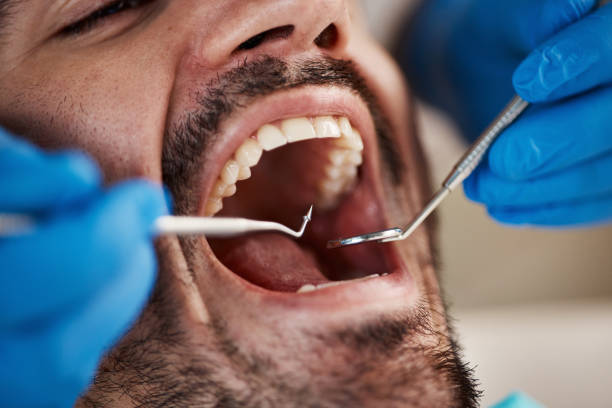 Best Dentist for Tooth Abscess  in Madison Heights, MI